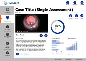 Figma concept of single video report